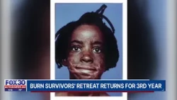 Beyond Scars burn survivors’ retreat returns for year 3